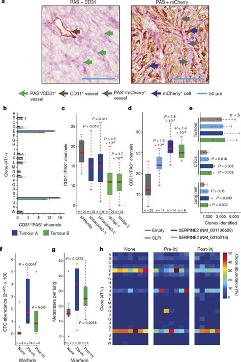 Vascular Mimicry Drives Metastatic Progression A Serial Sections Of A