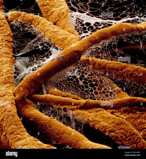 False Colour Scanning Electron Micrograph Sem Of The Tangled Hyphae