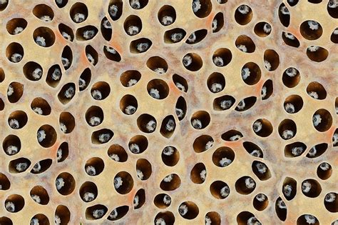 What Is Trypophobia