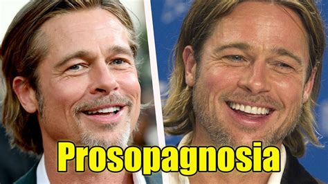 What Is Prosopagnosia A Rare Disorder Megastar Brad Pitt Struggled