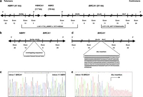 Genomic characterization of two large Alu-mediated rearrangements of ...