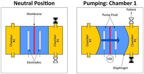 capabilities   generation patch pump improved precisioninstant