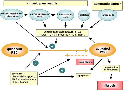 Chronic pancreatitis pathophysiology - wikidoc