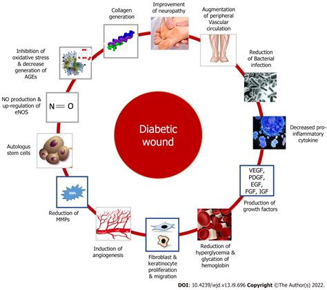 Evolving spectrum of diabetic wound: Mechanistic insights and ... 