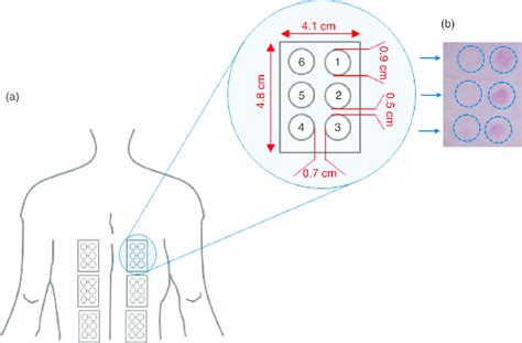 A Uv Exposure Site And Subsites B Minimal Erythema Dose Med Download Scientific Diagram