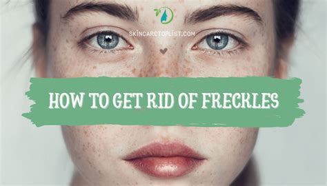 Goodbye Freckles How To Get Rid Of Freckles On Your Skin Skincare Top List