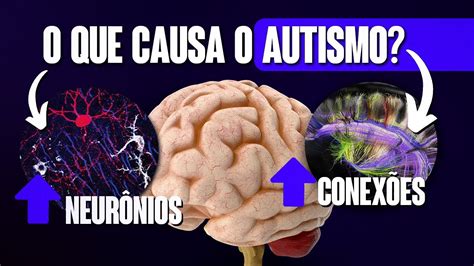 COMO É O CÉREBRO AUTISTA YouTube