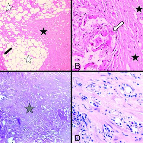 -Photomicrographs. A (Hematoxylin and Eosin, × 5) & B (Hematoxylin and ...