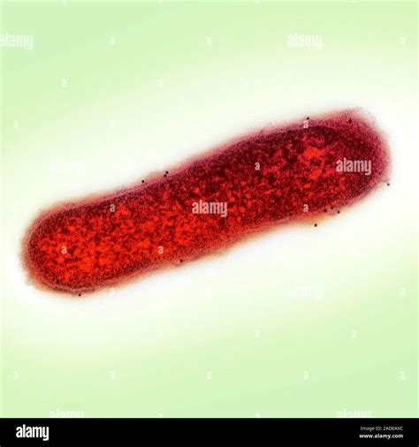 Cholera Bacterium Transmission Electron Micrograph Tem Of A Section Through A Vibrio Cholerae