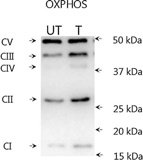 Representative Blot Of Oxphos Protein Content From Untrained And