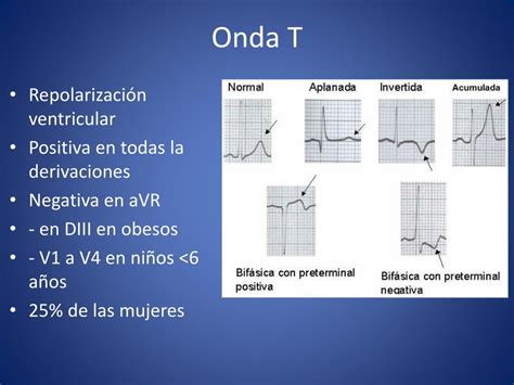 PPT Curso de Electrocardiografía Normal PowerPoint Presentation free