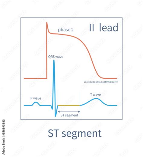 The ST Segment Of The ECG Is Equivalent To The Second Phase Of The