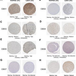 Representative Immunohistochemistry Images Of Cbxs From The Human