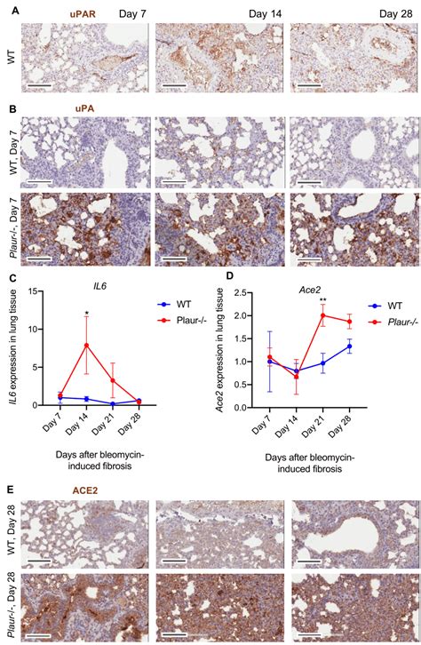 Upar Deficiency Leads To Upa Accumulation And Increased Il And Ace