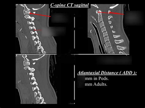 Msk Radiology 34 Diagram Quizlet