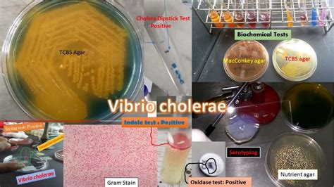 Vibrio: Introduction, Morphology, Culture Characteristics, Pathogenesis