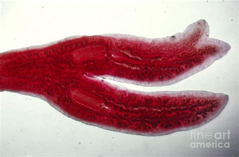 Planaria Photograph By Cbsscience Source Pixels