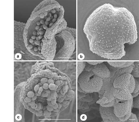 Sem Analysis Of Anthers And Pollen Grains Fertile And Sterile Of