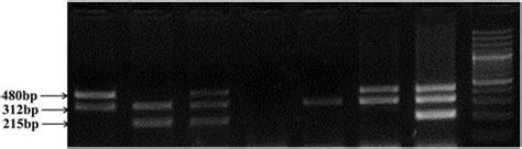 Amplified Pcr Products Of The Gstt And Gstm Gene Polymorphism In The