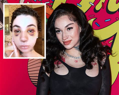 Bhad Bhabie Reveals She Got Nose Job And Clarifies Cancer Diagnosis