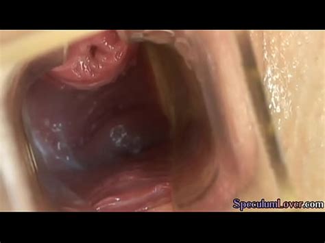 Speculum Babe Masturbating Then Spreads Pussy Xvideos