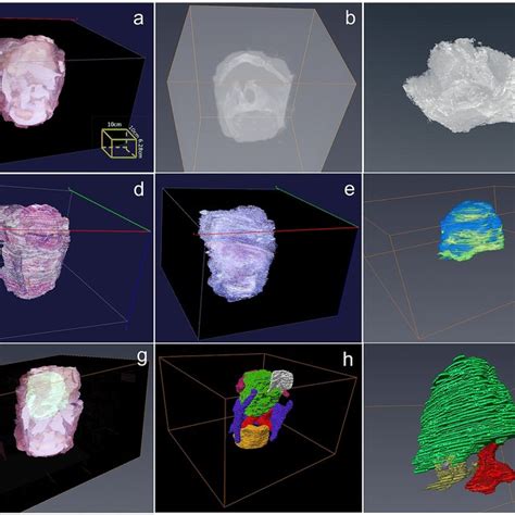 A Diagram Representing The Flow Of Histological Data Processing And