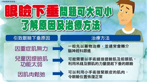 了解眼瞼下垂成因：年紀大眼皮鬆弛？經常佩戴隱形眼鏡？突然大細眼提防神經病變？ 明報健康網