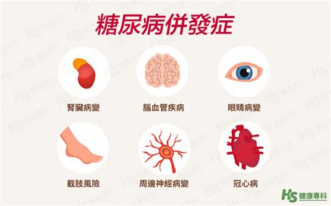 糖尿病是吃太多糖嗎？醫師帶你了解糖尿病前兆、症狀、飲食與治療 健康專科