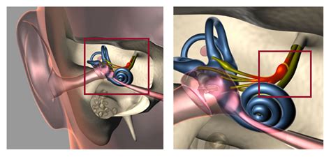 Vestibular Neuritis Symptoms Causes Diagnosis And Treatment