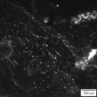 Tem Micrograph Showing In A Dark Field Contrast Taken From A Cn