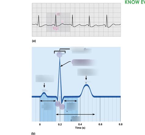 Ecg Diagram Quizlet