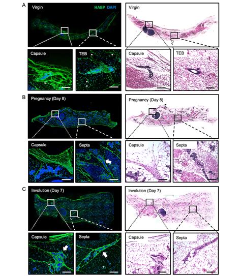 Organized Hyaluronan Rich Septa Are Deposited Throughout The Developing