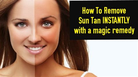 How To Remove Sun Tan Instantly And Lighten Tanned Skin At Home Sandhy