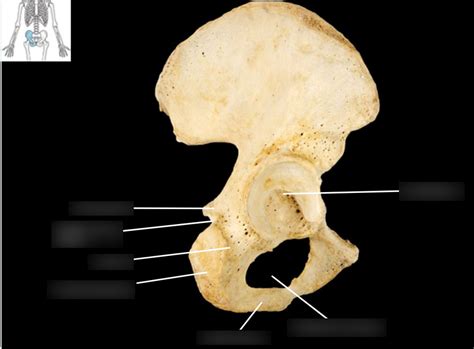 Ischium Lateral View Diagram Quizlet