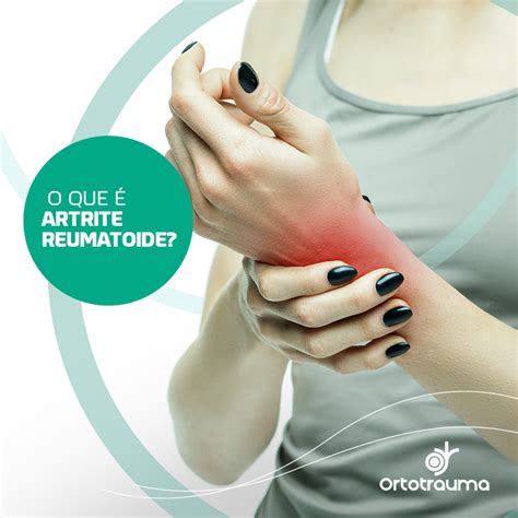 O Que é Artrite Reumatoide Ortotrauma