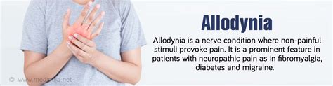 Allodynia Types Causes Symptoms Diagnosis Treatment And Risk Factors ...