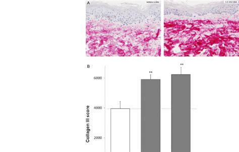 A Immunohistochemical IHC Staining For Type 3 Collagen In Human Ex