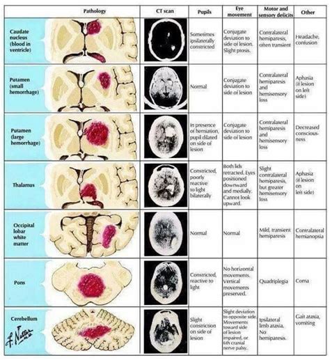 Understanding Stroke Chart 20×26 Artofit