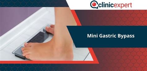 Mini Gastric Bypass Clinicexpert