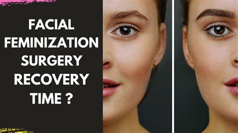 Facial Feminization Recovery Time Explained By Facial Plastic Surgeon