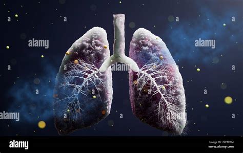 Doctors Hand Infected Lungs Concept Tuberculosis Mycobacterium