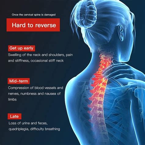 Buy Badez Inflatable Naked Cervical Traction Device Adjustable Levels For Multidirectional