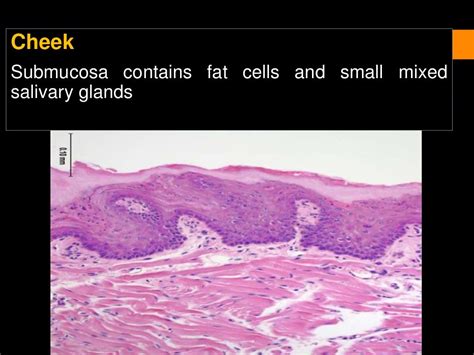 Histology of oral mucous membrane and gingiva