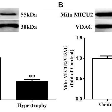 The Expressions Of Mitochondrial MICUs Were Reduced In Ang II Induced