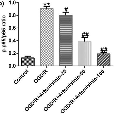 ART inhibits the activation of NF κB signaling pathway in OGD R induced