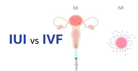 Iui Vs Ivf Which One Is Right For You Birla Fertility Ivf