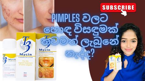 Pimples T Mycin Clindamycin