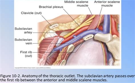 Class 9- Upper Extremity Arterial Duplex Scanning Flashcards | Quizlet