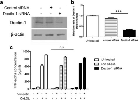 Effects Of Vimentin On Nf κb Activation And Tnf α Secretion Are Not