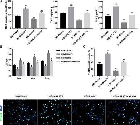 Long Noncoding Rna Malat Mediates High Glucoseinduced Glomerular